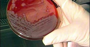 Anthrax Found In Connecticut - CBS News