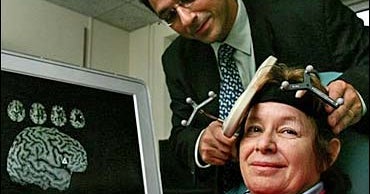 Zapping After Strokes Has Promise - CBS News