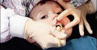 Sweetener May Prevent Cavities in Toddlers CBS News