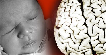 Cooling Babies May Help Brains CBS News