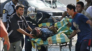 An Iraqi suffering from a serious head wound is taken from the scene of a massive car bomb 