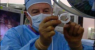 Diabetics Obesity Surgery Stomach Stapling for the NotSoFat? CBS News