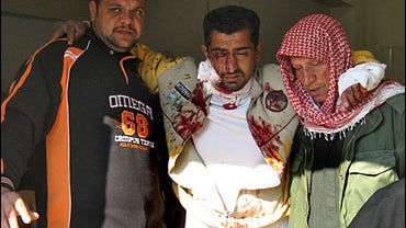 A wounded man is treated in al-Kindi hospital in Baghdad, Iraq, Friday Jan. 26, 2007 after being hurt in an explosion at animal market. 
