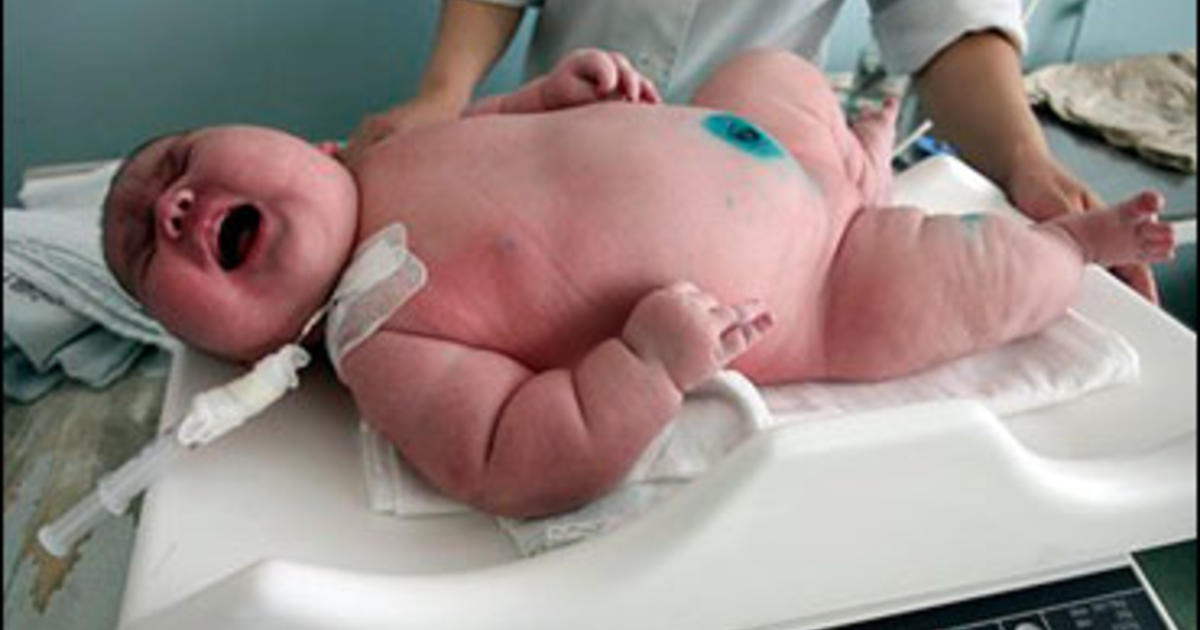 Oh, Baby! A 17-Pound Delivery In Russia - CBS News
