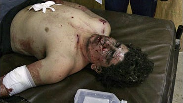 A man wounded in a market bombing lies in hospital, in central Baghdad, Iraq, Friday, Feb. 1, 2008. 