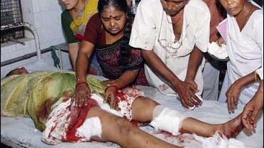 An injured victim of a bomb explosion lies on a hospital bed in Ahmadabad, India 