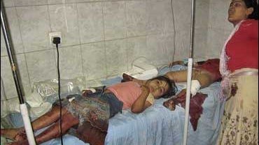 iraq suicide bomber hospital injuries children 