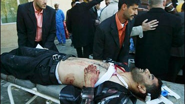 A wounded man is rushed to hospital after a suicide bombing in Kirkuk 