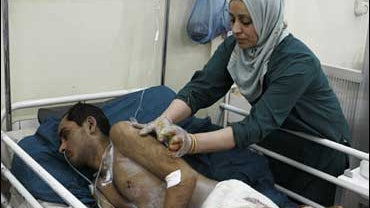 A policeman injured in a suicide bombing attack given medical treatment in a hospital in Baghdad 