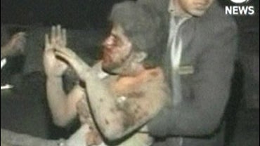 This image aired by Aaj Television shows a person injured by an explosion in Peshawar, Pakistan 