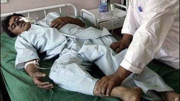 An Afghan doctor holds legs of an injured passenger at a hospital after their bus was hit by a mine in Kandahar province, south of Kabul, Afghanistan on Tuesday, Sept. 29, 2009. Kandahar provincial police chief Sardar Mohammad Zazai said nine women and se 