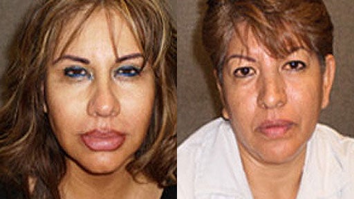 Alejandra Viveros and Guadalupe Viveros, two sisters wanted in connection with silicone implant death in Los Angeles. 
