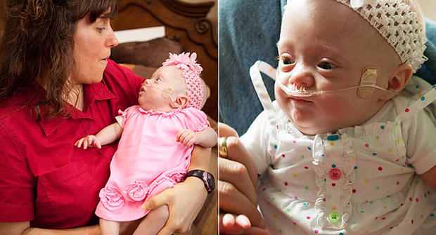 Michelle Duggar and little Josie Brooklyn Duggar, who was born two months prematurely. 
