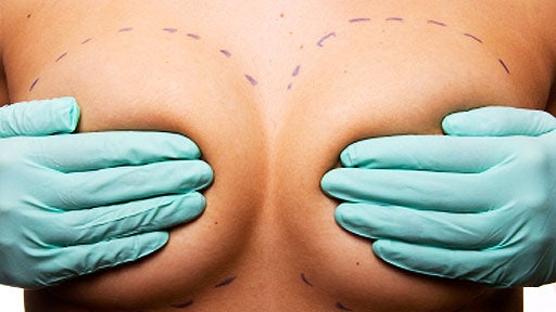 hands, breasts, woman, generic, istockphoto, breast implant, surgery 