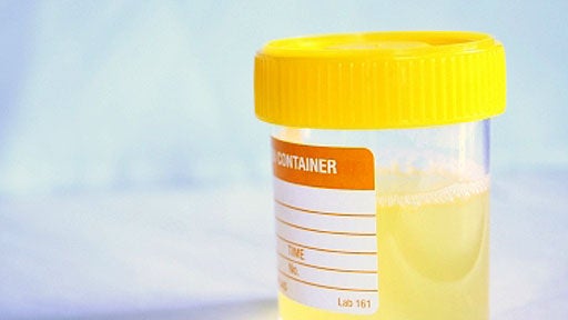 urine sample 