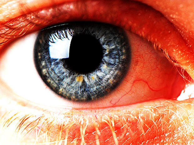 blue-eye-2.jpg 