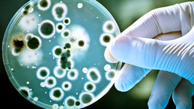 15 superbugs and other scary diseases 