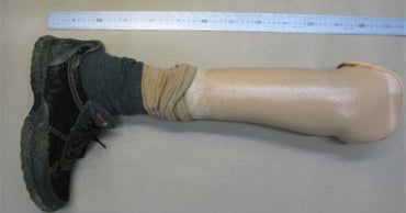 Danish Cops: 1-Legged Suspect Hurt by Own Bomb - CBS News