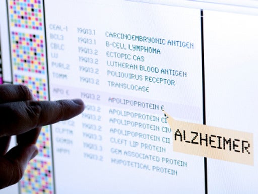 Alzheimer's, science, dementia, generic, 4x3