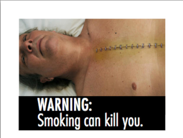 Proposed Cigarette Warning Label 