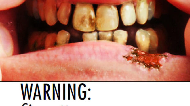 33 New Terrifying Tobacco Warning Labels 