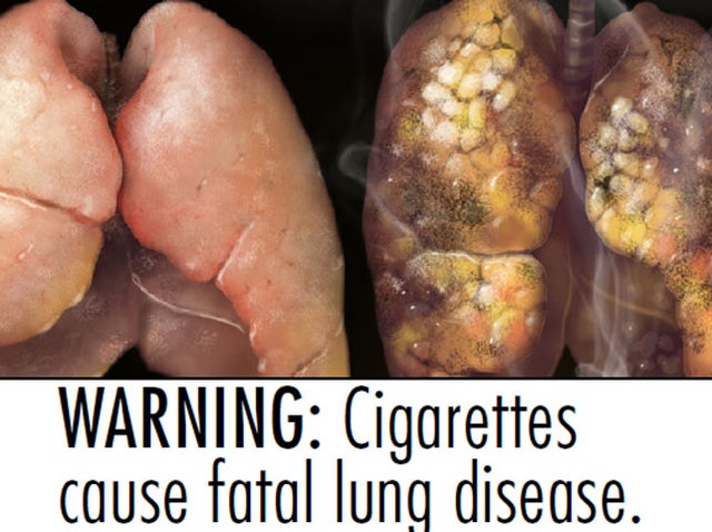55 gruesome tobacco warning labels