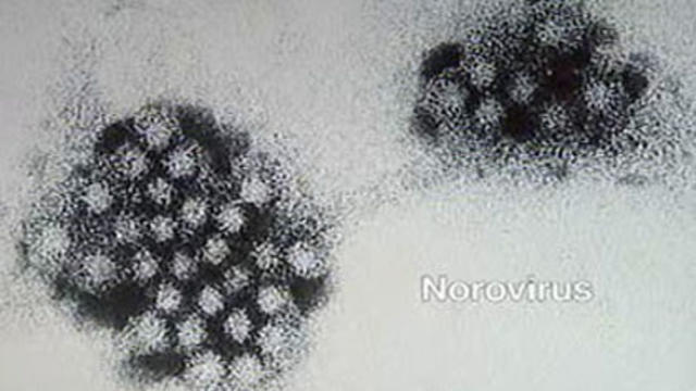 norovirus_1116.jpg 