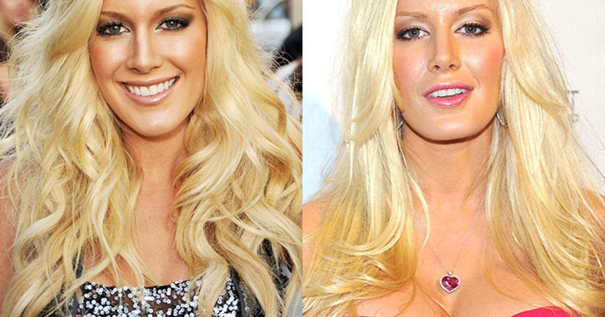 Celebrity Plastic Surgery Disasters?