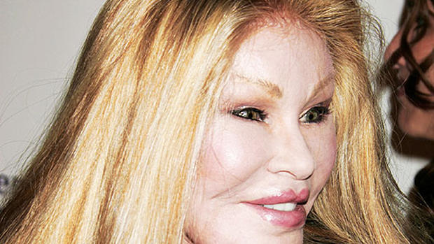 Celebrity Plastic Surgery Disasters? 