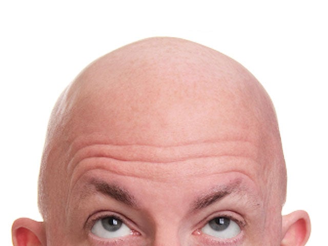 bald man
