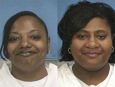 Kidney Sisters Released From Prison, One Must Donate Kidney To Other 