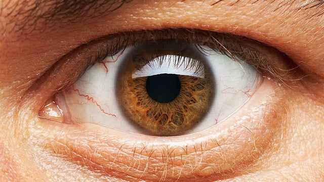 eye, brown, 4x3, stock 