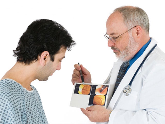 colonoscopy, colon cancer, stock, 4x3 