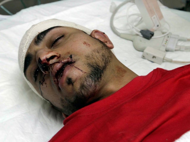 A wounded Shiite Bahraini demonstrator 