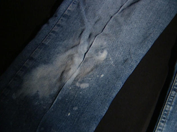 Susan Wright's bleach-stained jeans 