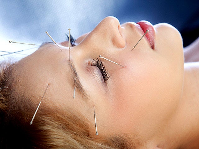acupuncture_iStock_00001447.jpg