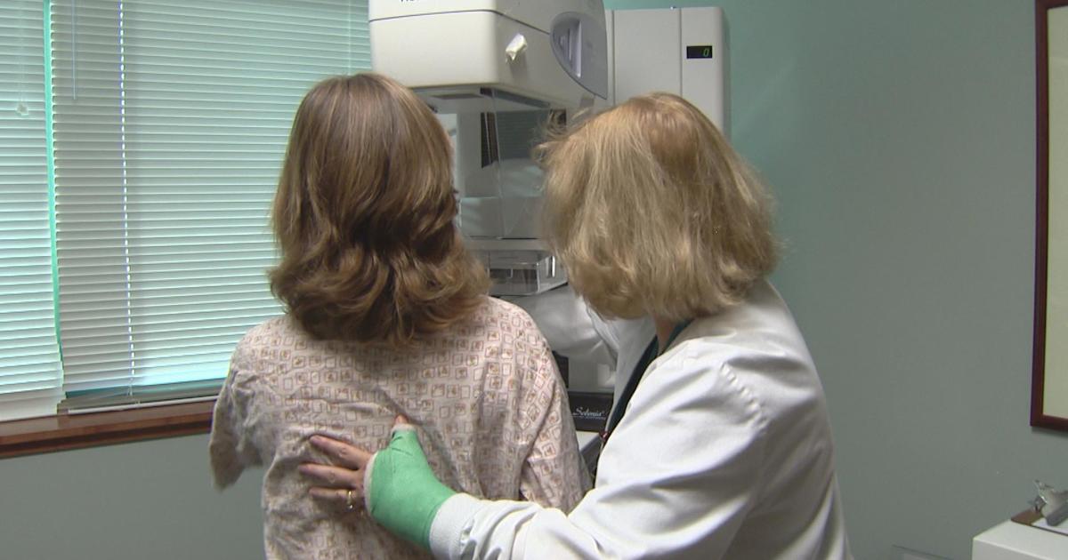 New Recommendations For Mammograms Should You Follow Them Cbs Colorado