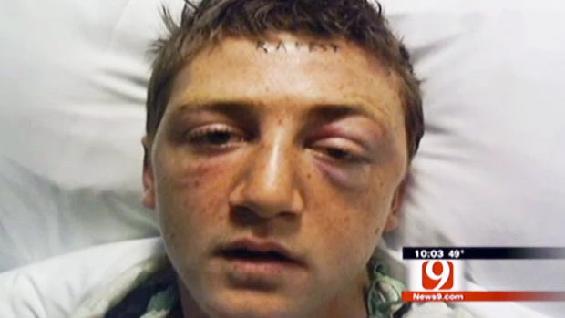 Oklahoma City man's attackers tattooed 'RAPEST' on his forehead 
