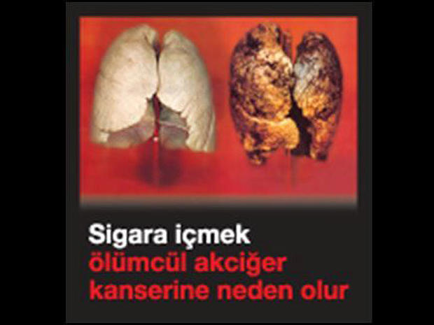 turkey-tobaccowarninglabel.jpg 