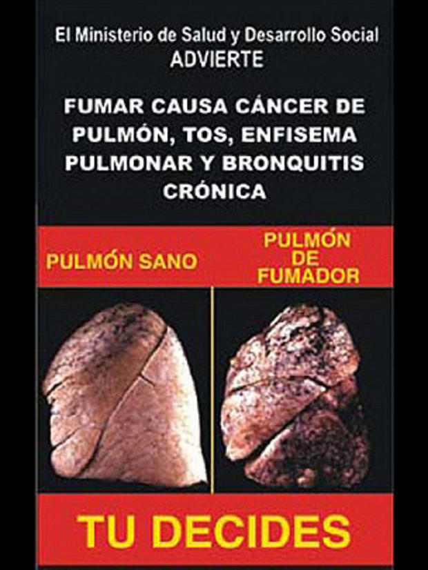 venezuela-tobaccowarninglabel.jpg 