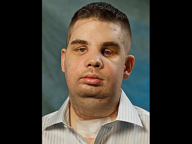aftertransplant.jpg 