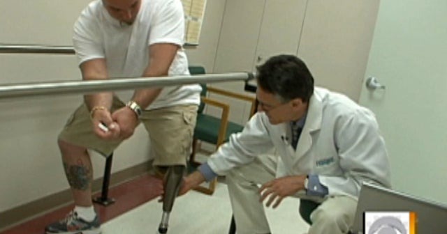 Troops' new bionic leg now for civilians, too - CBS News