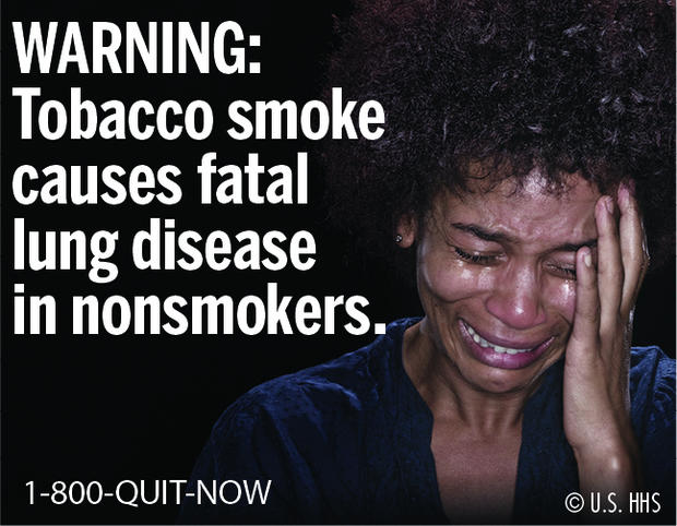 Tobacco smoke causes fatal lung disease in nonsmokers 