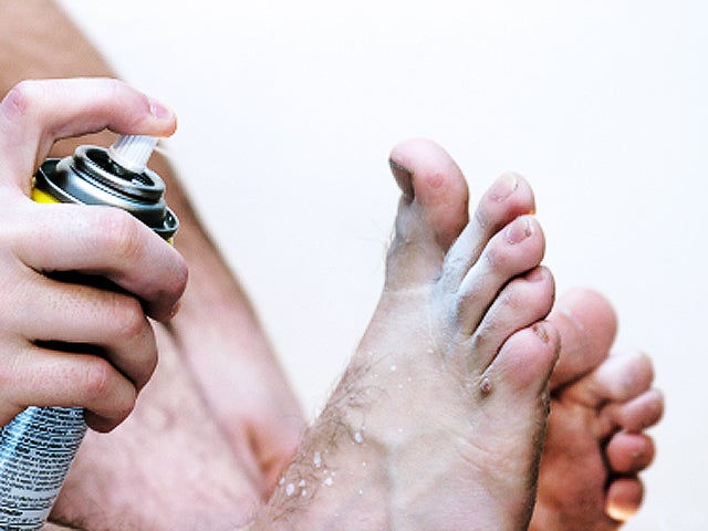 athlete's foot, foot fungus, foot, stock, 4x3 