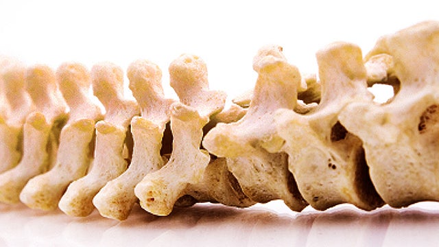 bones, spinal cord, spine, bone, vertebrae, stock, 4x3 