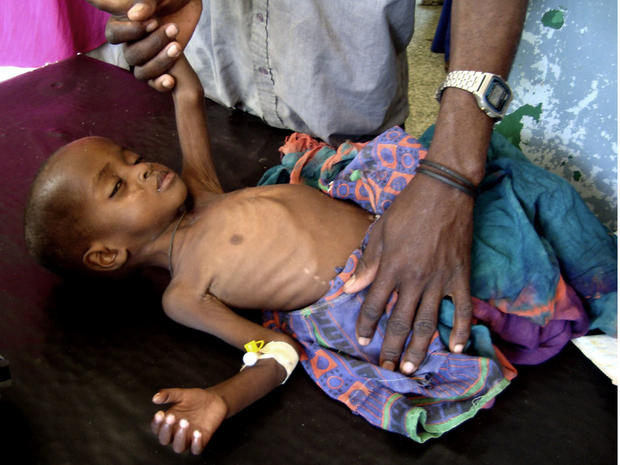 Somalia, famine, drought 