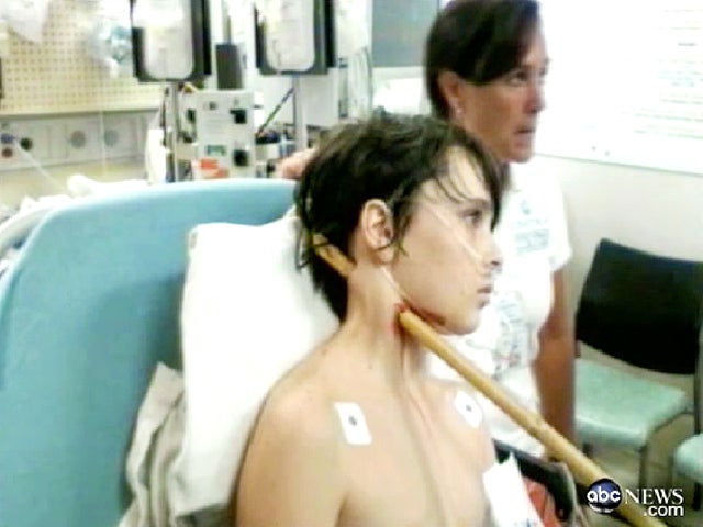 Teen's run-in with bamboo stick spotlights impalement injuries - CBS News
