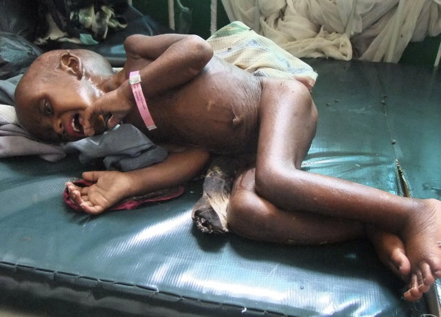somalia_famine_6_AP110726119636.JPG 