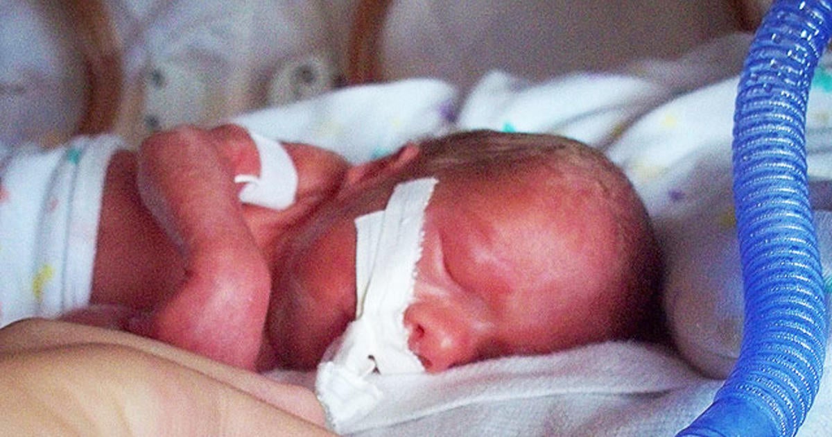 Premature birth tied to premature death in adults - CBS News