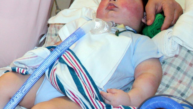 Joseph Maraachli, the 20-month-old who became widely known as Baby Joseph, is seen April 21, 2011, at SSM Cardinal Glennon Children's Medical Center in St. Louis. Family spokesman and spiritual adviser Brother Paul O'Donnell says Joseph died at home Sept. 